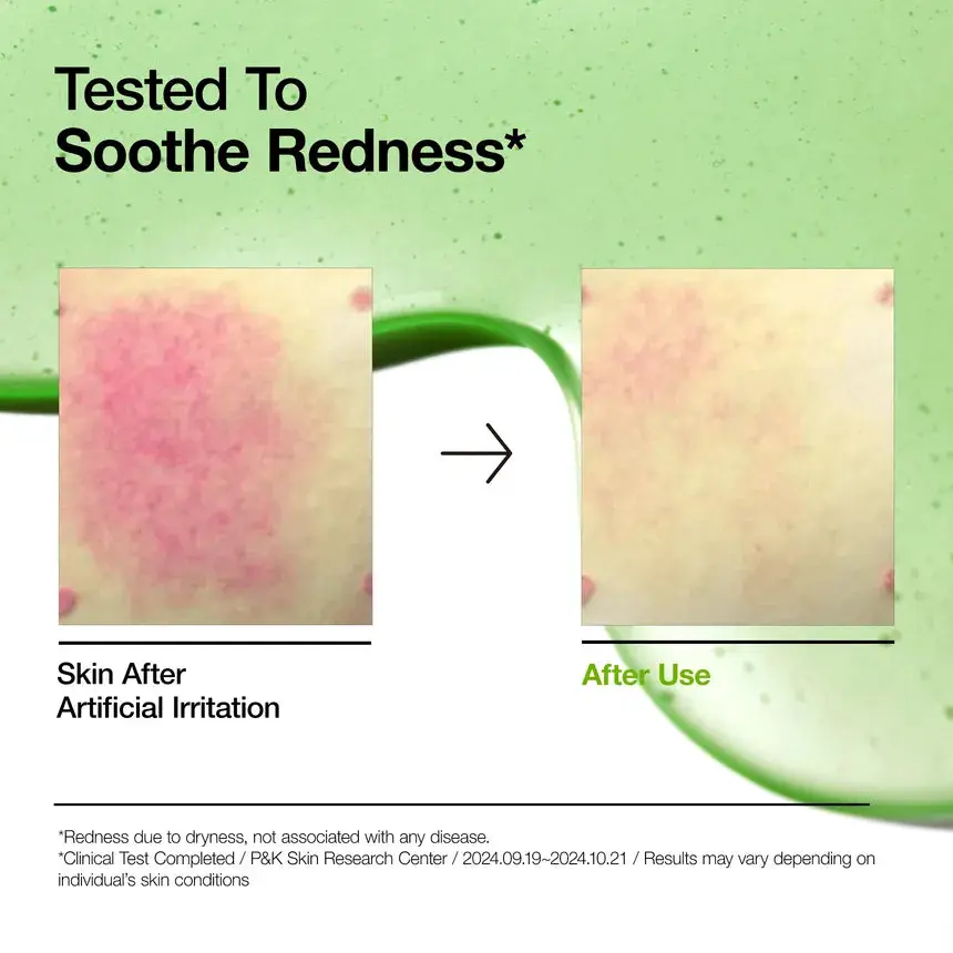 Azelaic Acid 10 Hyaluron Redness Soothing Serum - Image 3