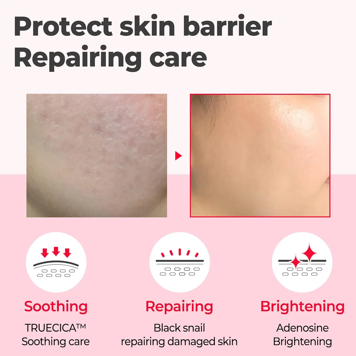 Snail Truecica Miracle Repair Serum - Image 2